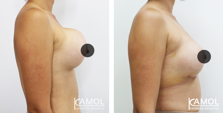 lg-64dc4228c1ce3-image