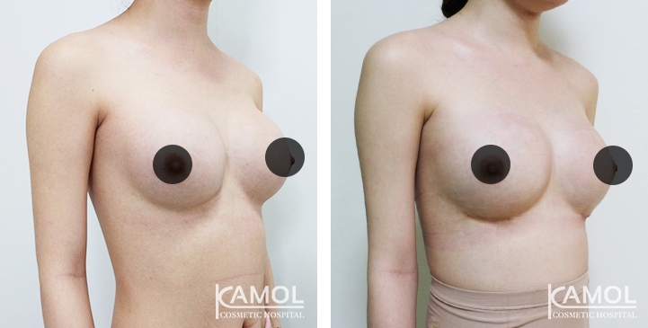 lg-64dc425147659-image