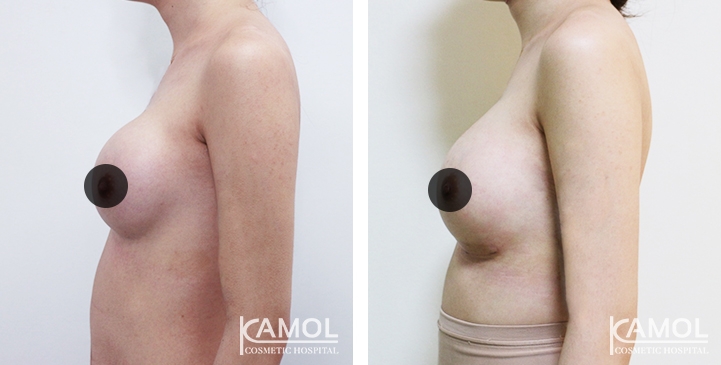 lg-64dc4251b486e-image