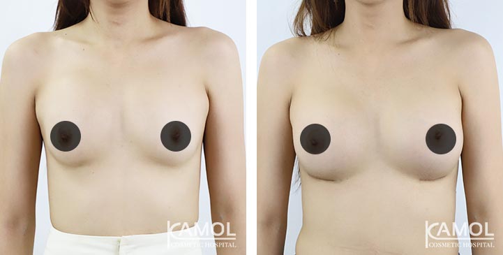 lg-64dc4268c5978-image