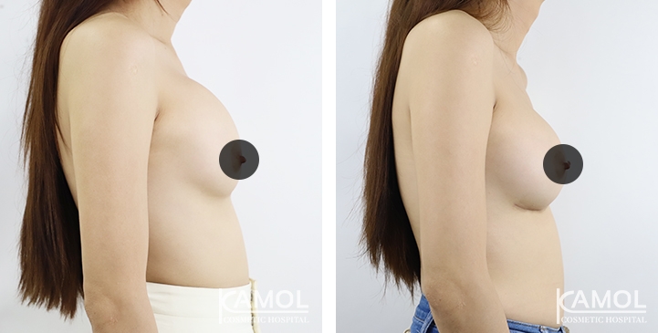 lg-64dc4268e01f2-image