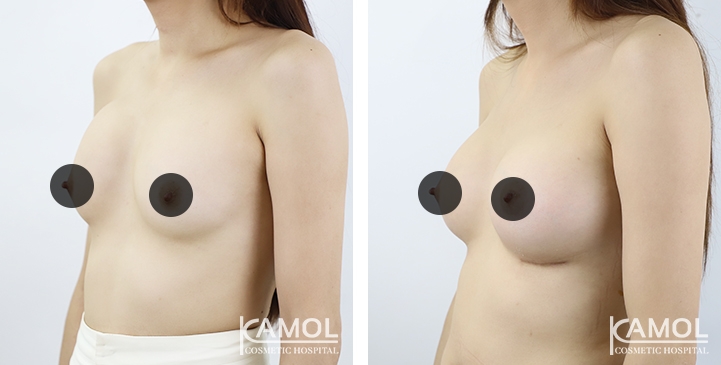 lg-64dc42690a54e-image