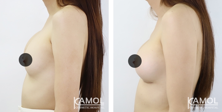 lg-64dc42694486f-image