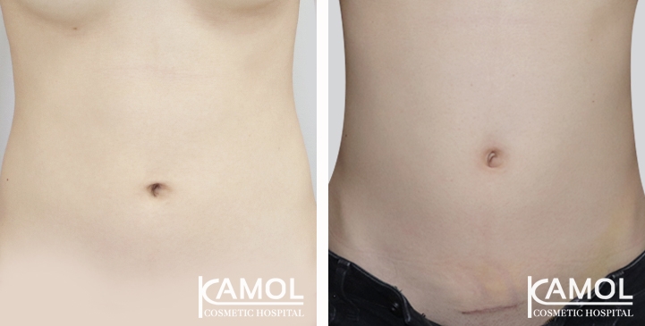 lg-650c28ccaaf24-image