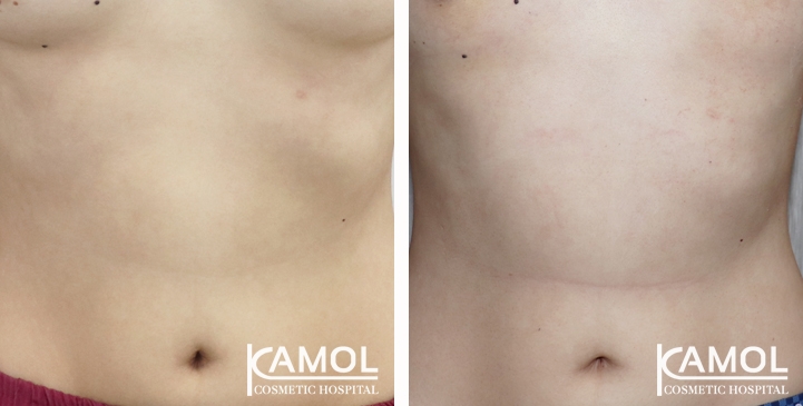 lg-650c29715bc08-image