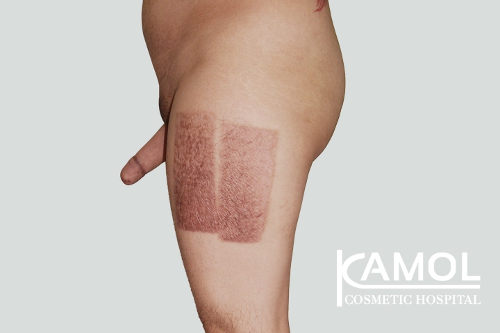 lg-650d98ab01ce0-image