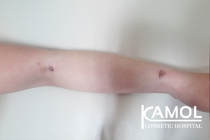 lg-650d98b8e195b-image