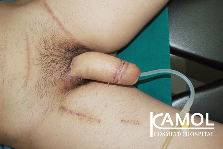 lg-650d98bc57be6-image