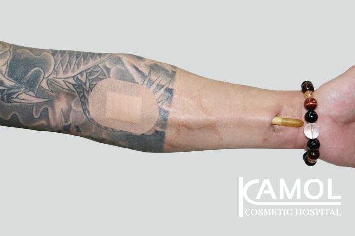 lg-650d993121a8b-image