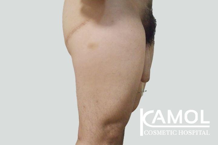 lg-650d998fa8965-image