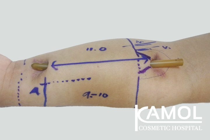 lg-650d9996a9f59-image