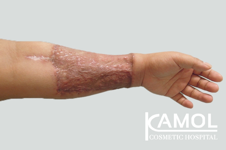 lg-650d999a609de-image