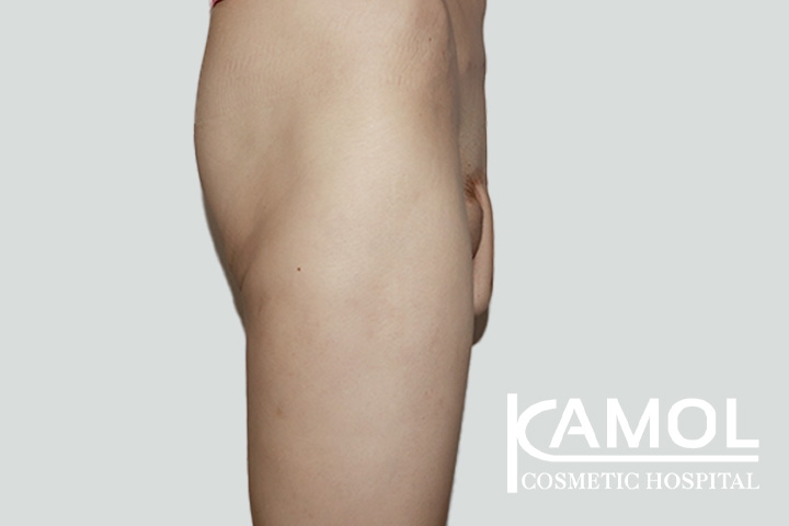 lg-650d99f20ffd1-image