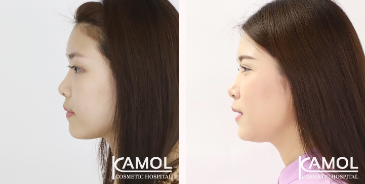 lg-65125fa0656ff-image