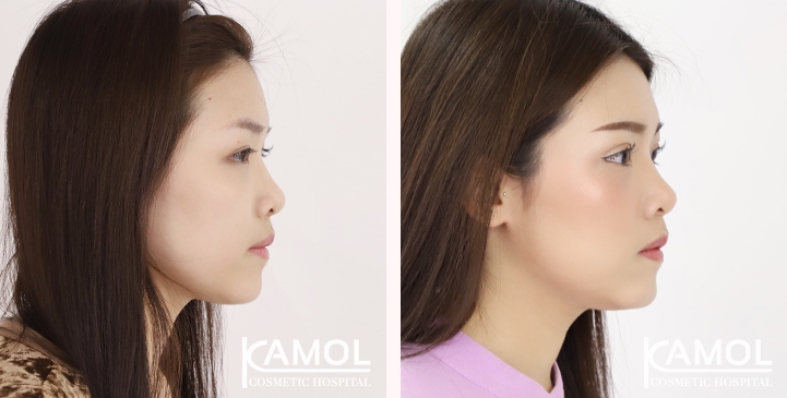 lg-65125fa0847c6-image