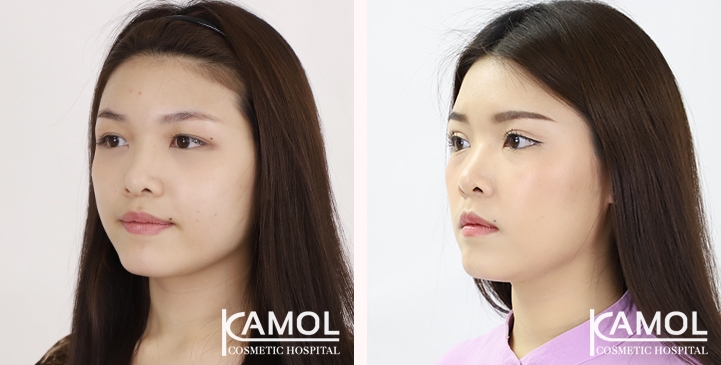 lg-65125fa0a566f-image