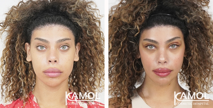 lg-6531ec81bfb13-image