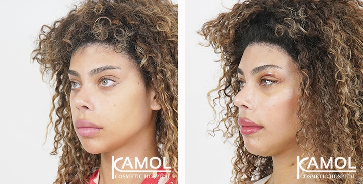 lg-6531ec81e6642-image