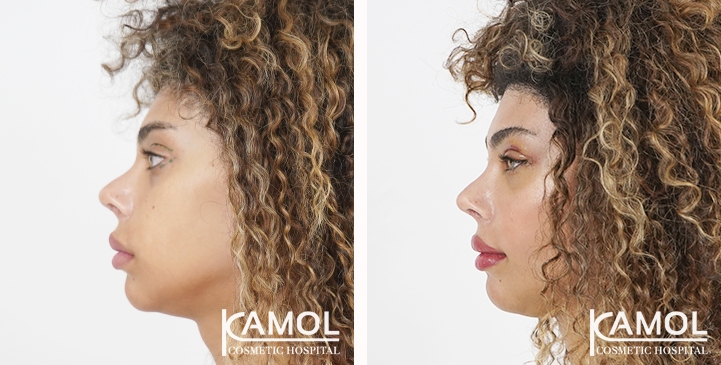 lg-6531ec821307c-image