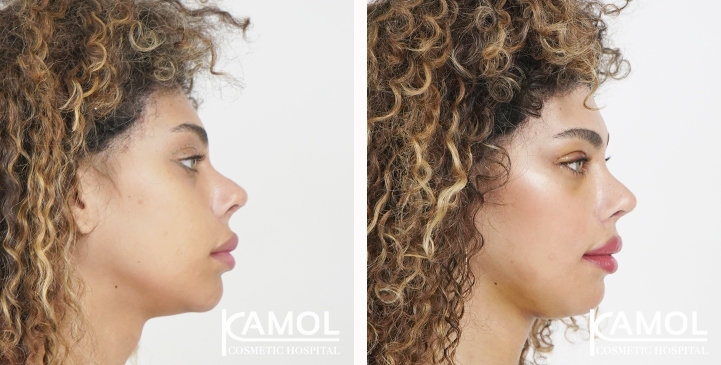 lg-6531ec8258b52-image