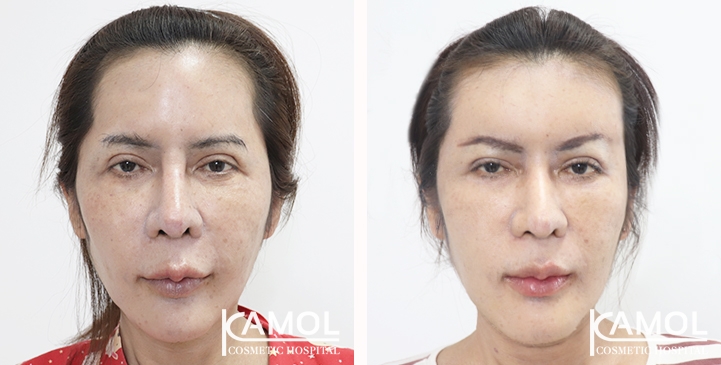 lg-6532226b55430-image