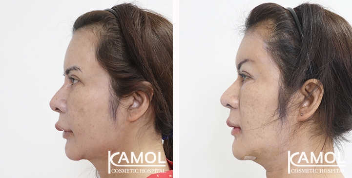 lg-6532226b76514-image