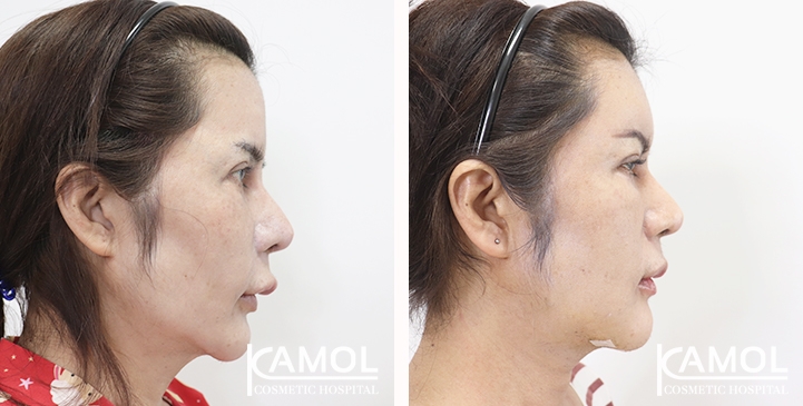 lg-6532226b95f07-image