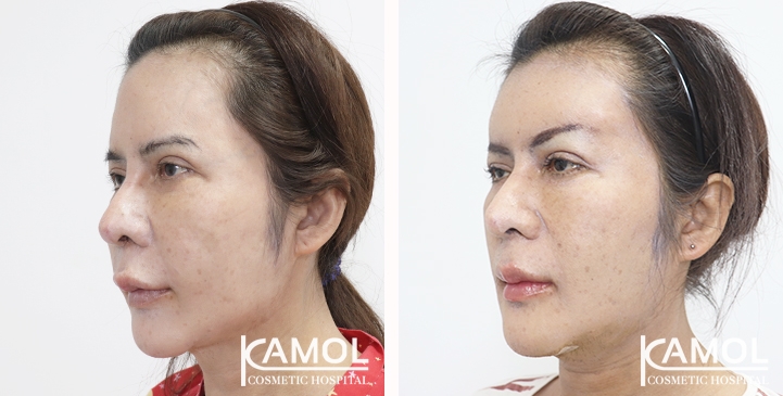 lg-6532226bb5a99-image