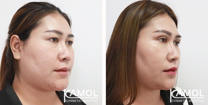 lg-65388474886e5-image