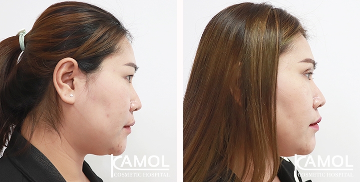 lg-653884778c9f1-image