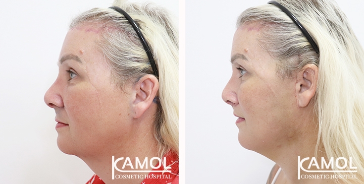 lg-654075f1920d3-image