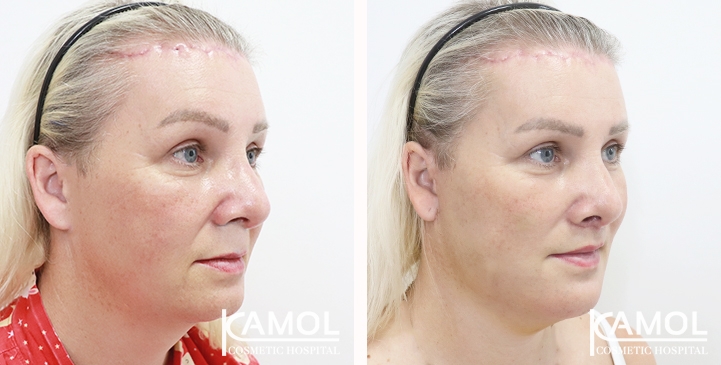 lg-654075f1b5ffb-image