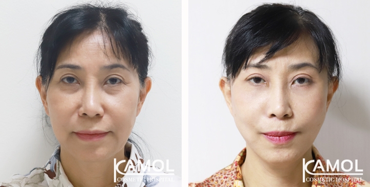 lg-65b87f2057be2-image