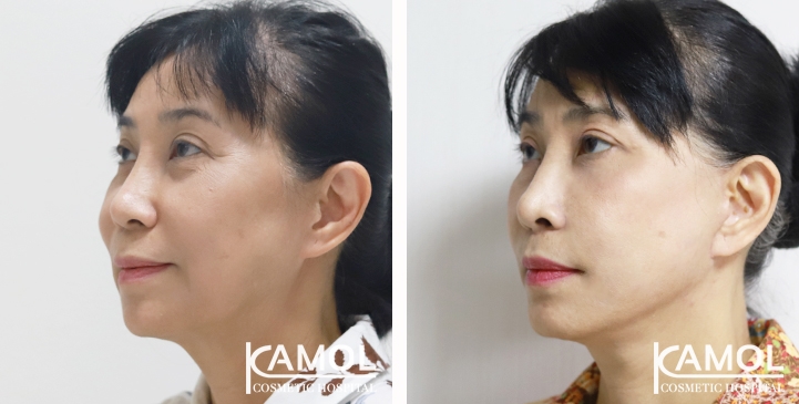 lg-65b87f2090437-image