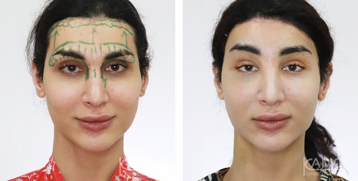 lg-65b88045453a3-image