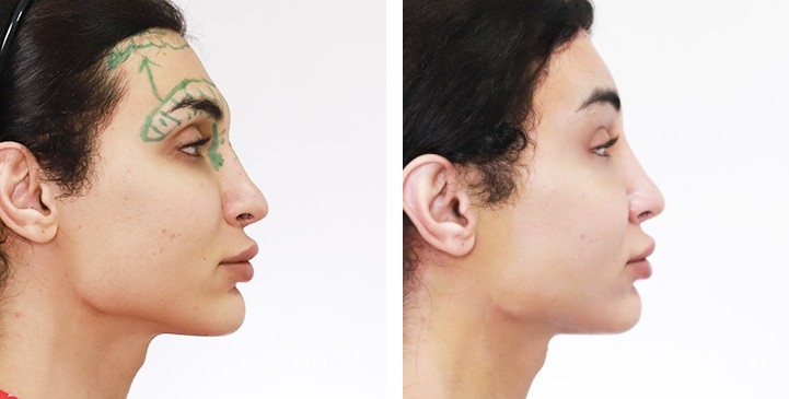 lg-65b880456d62d-image