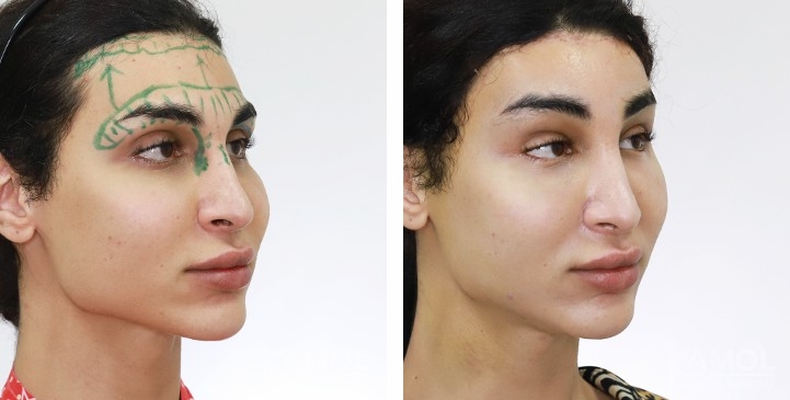 lg-65b880458bd86-image