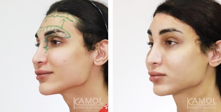 lg-65b88045aa262-image