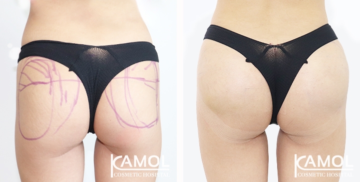 lg-65eec897ad523-image