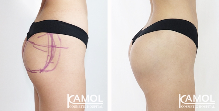 lg-65eec89a53a23-image