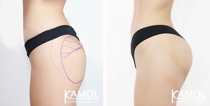 lg-65eec89f203a6-image