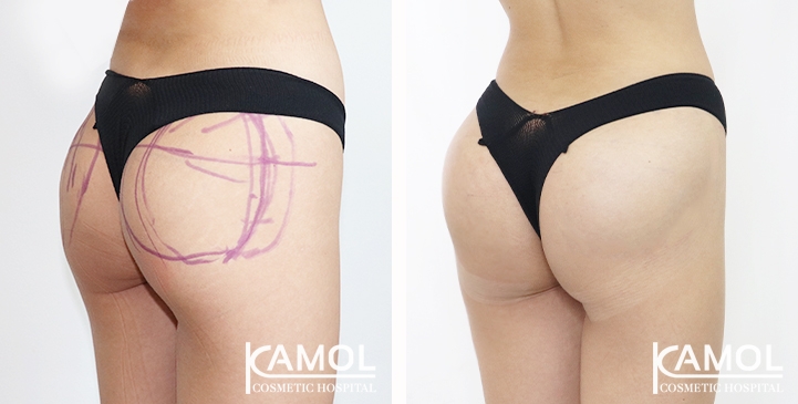 lg-65eec8a966a61-image