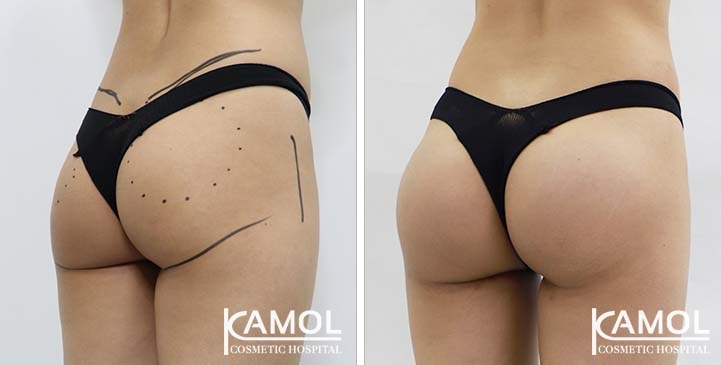 lg-65eec9663428e-image