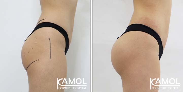 lg-65eec9665554c-image