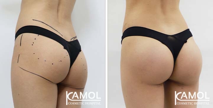 lg-65eec96672a1e-image