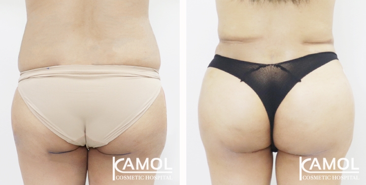 lg-65eec9c145096-image