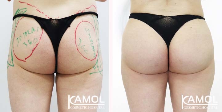 lg-65eeca4dd5438-image