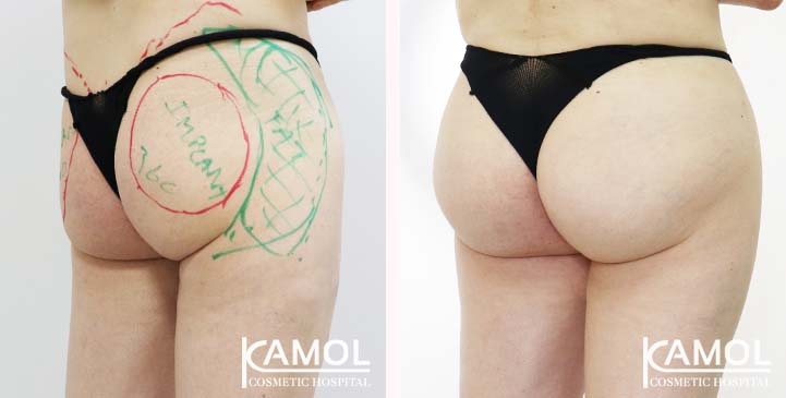 lg-65eeca4e1bca1-image