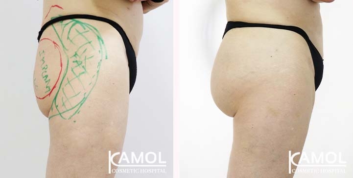 lg-65eeca4e393ab-image