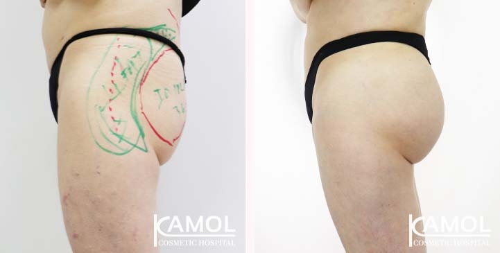 lg-65eeca4e57438-image